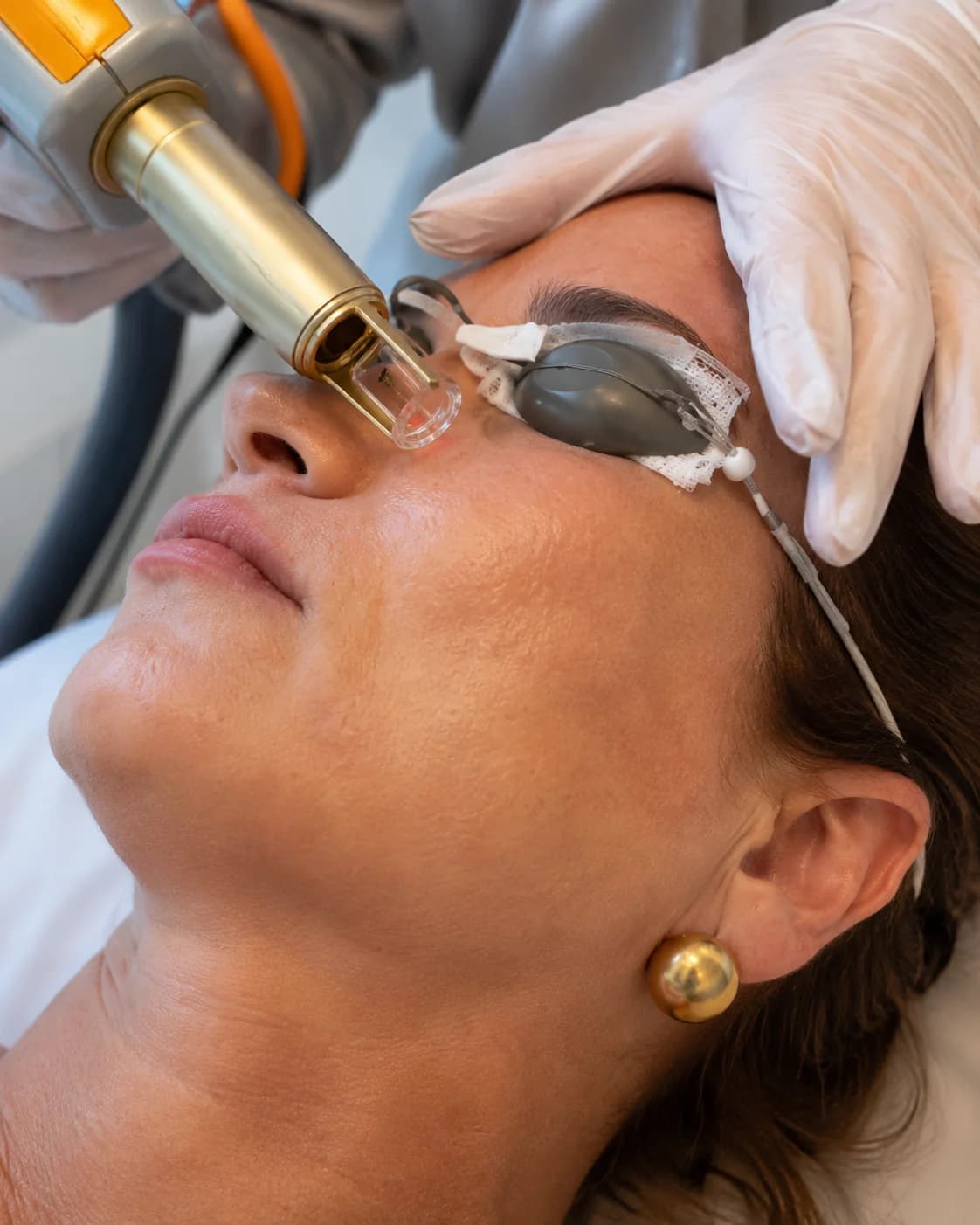 Laser com Ativos — Klinicá Dermatologia, Barra da Tijuca